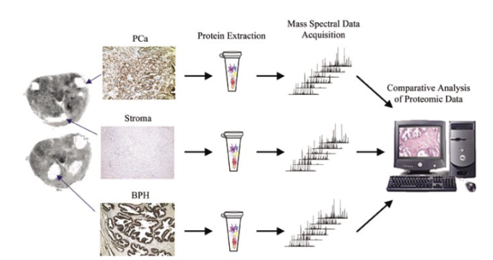 Oncobloc – FFPE Collections – Sapien Biosciences