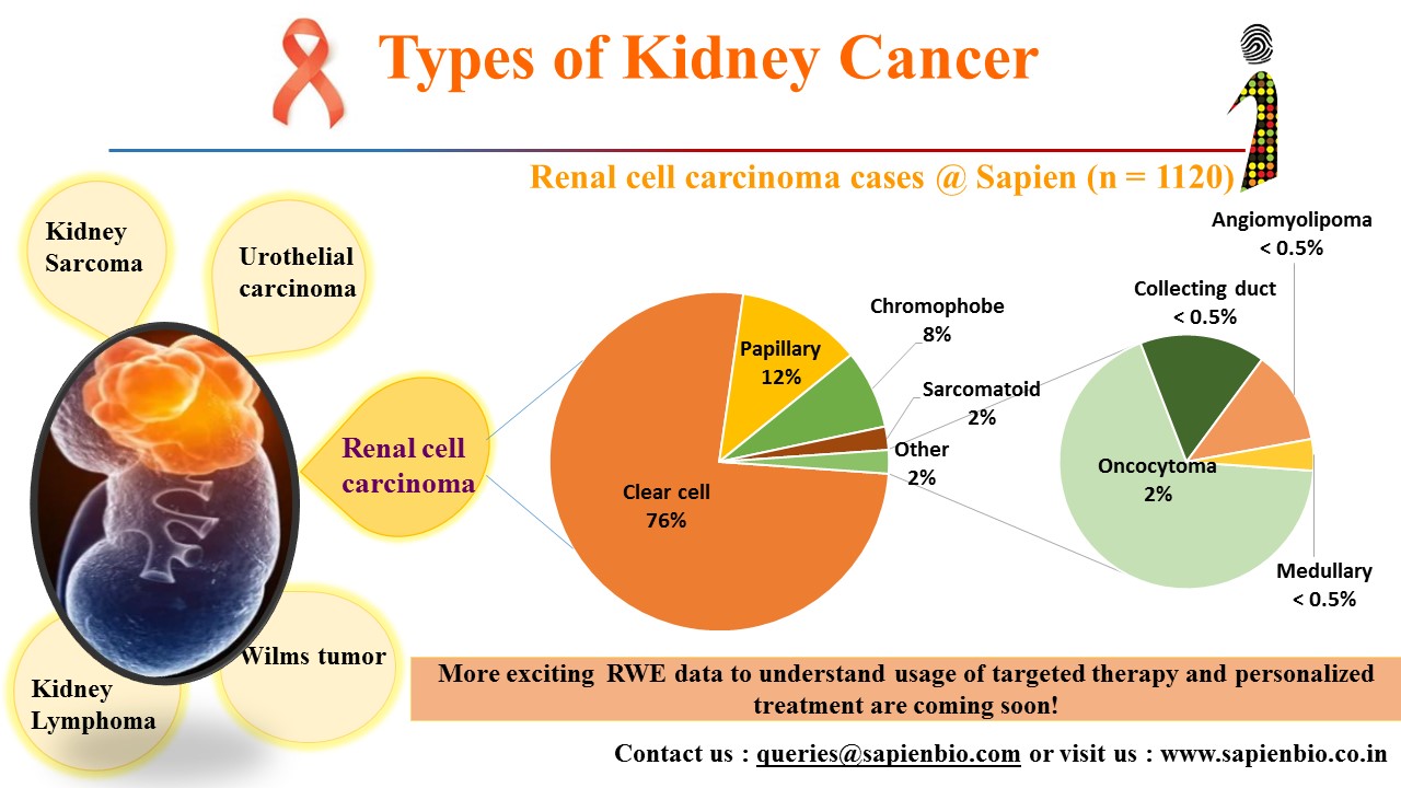 Types Of Kidney Cancer Sapien Biosciences
