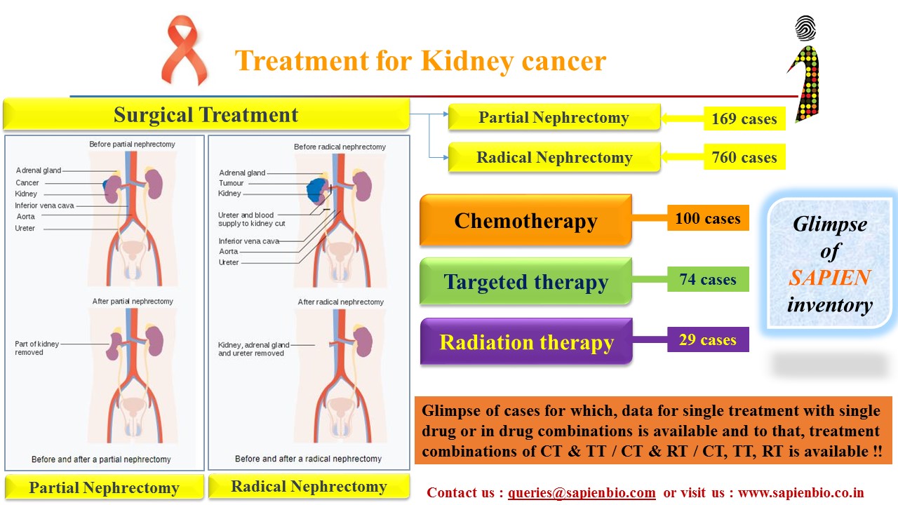 Treatment For Kidney Cancer Sapien Biosciences